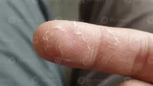 Wie feucht darf eine Wand sein? Feuchtigkeit in Wänden: Welche Werte sind normal und wann besteht Handlungsbedarf?